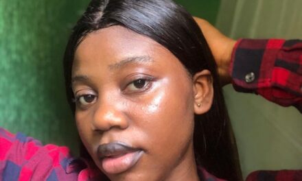 Hurt Men Because You Are Beautiful – _Oyebisi