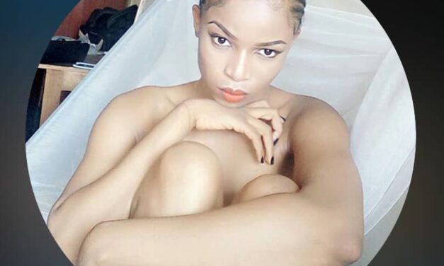 I Want People To Find A Way To Blame The Victim After He was Set Ablaze by His Wife – pretty_onuoha